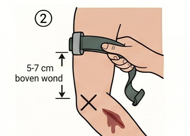 Leg tourniquet aan